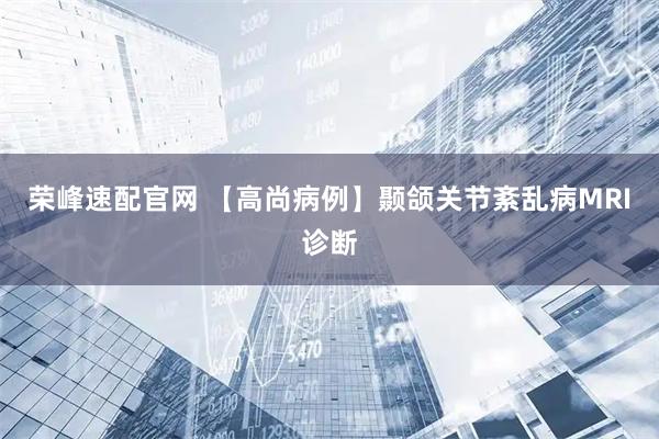 荣峰速配官网 【高尚病例】颞颌关节紊乱病MRI诊断